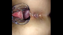 Inside the pussy with vaginal speculum
